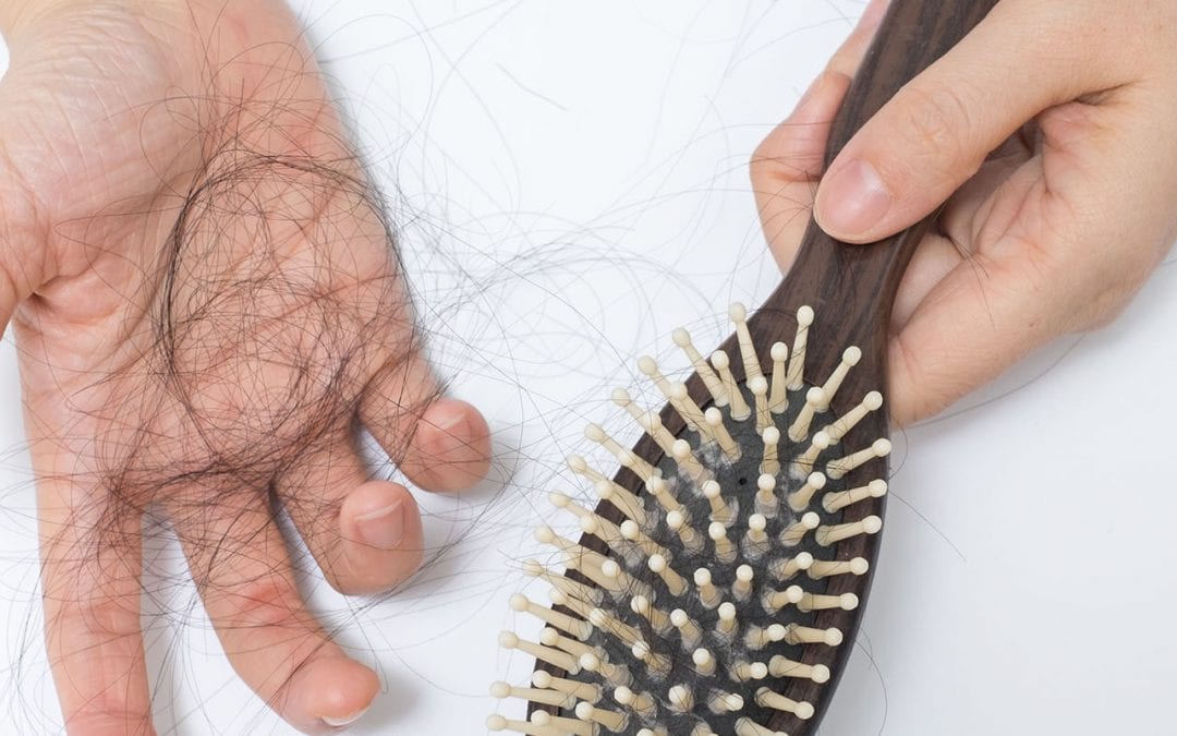 Thinning Hair or Hair Loss