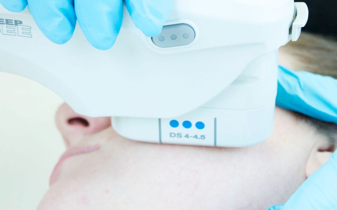 Ultherapy – for effective skin tightening